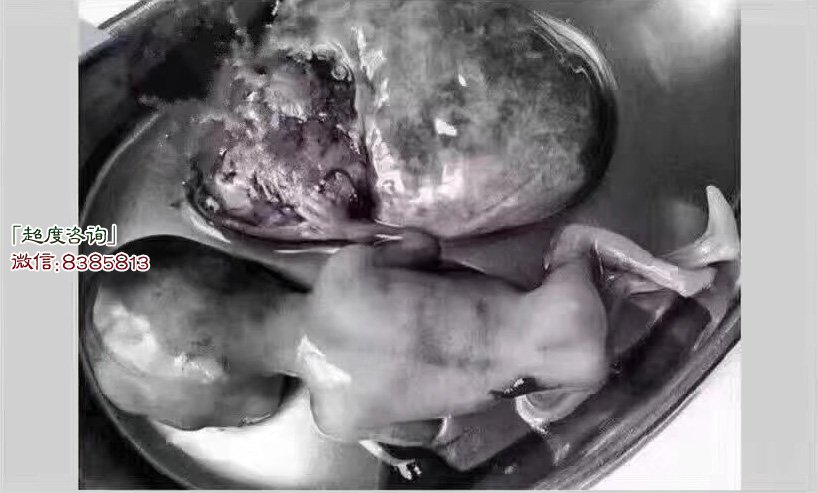 我超度婴灵的亲身经历